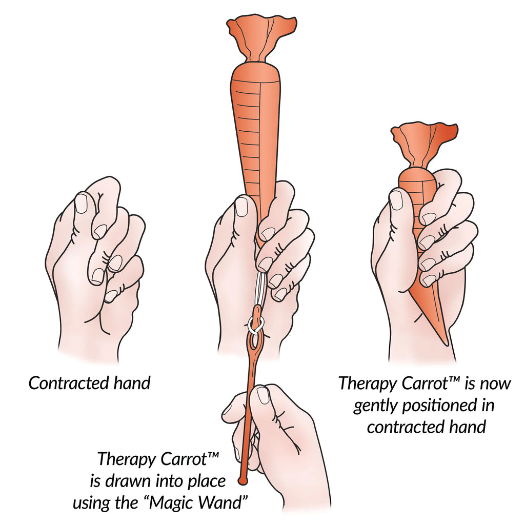 Therapy Carrot