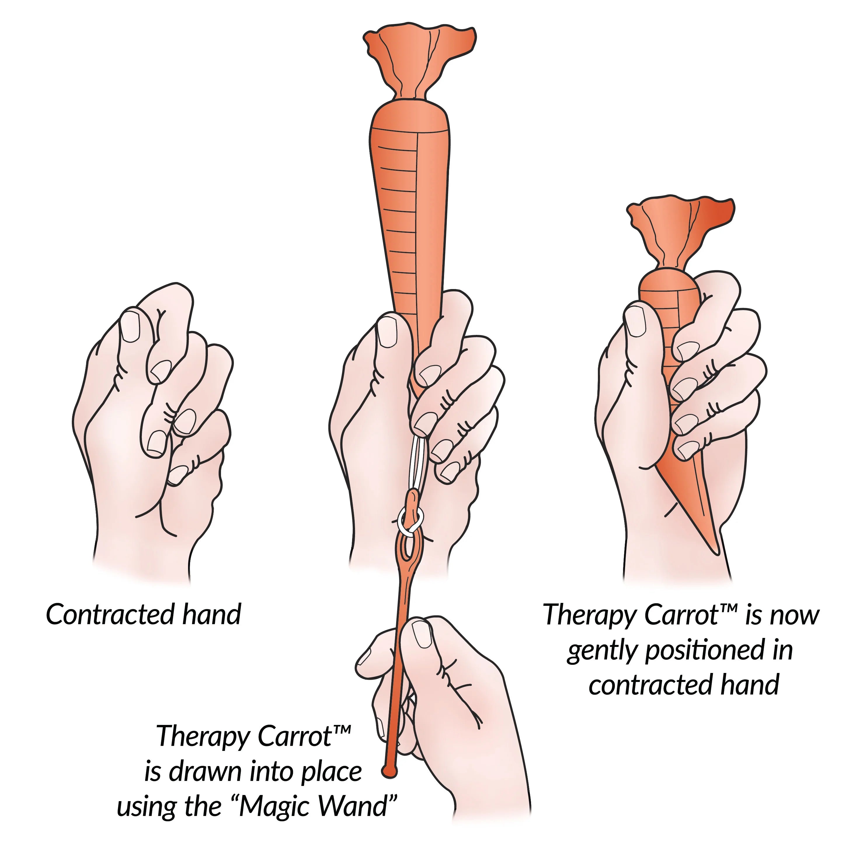 Therapy Carrot